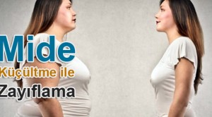 Mide küçültme ile zayıflama